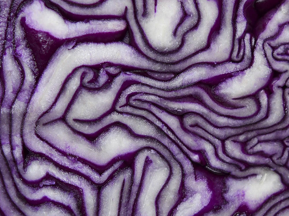 Rdkl